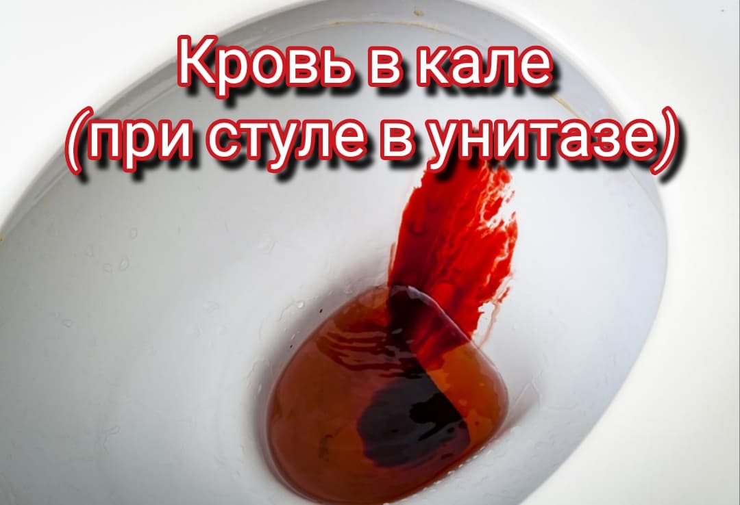 Какие основные причины выделения крови при дефекации.